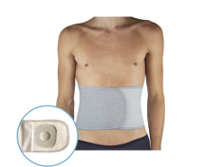 art.685 - Faixa Abdominal/Hérnia Umbilical
